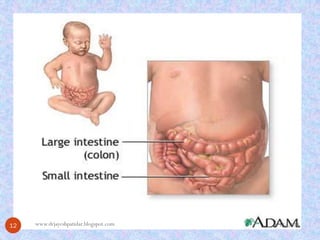 9/15/201412 
www.drjayeshpatidar.blogspot.com  