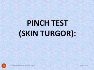 PINCH TEST (SKIN TURGOR): 9/15/2014 
25 
www.drjayeshpatidar.blogspot.com  