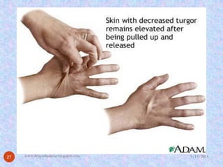 9/15/2014 
27 
www.drjayeshpatidar.blogspot.com  