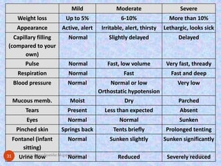 Mild 
Moderate 
Severe 
Weight loss 
Up to 5% 
6-10% 
More than 10% 
Appearance 
Active, alert 
Irritable, alert, thirsty 
Lethargic, looks sick 
Capillary filling (compared to your own) 
Normal 
Slightly delayed 
Delayed 
Pulse 
Normal 
Fast, low volume 
Very fast, thready 
Respiration 
Normal 
Fast 
Fast and deep 
Blood pressure 
Normal 
Normal or low Orthostatic hypotension 
Very low 
Mucous memb. 
Moist 
Dry 
Parched 
Tears 
Present 
Less than expected 
Absent 
Eyes 
Normal 
Normal 
Sunken 
Pinched skin 
Springs back 
Tents briefly 
Prolonged tenting 
Fontanel (infant sitting) 
Normal 
Sunken slightly 
Sunken significantly 
Urine flow 
Normal 
Reduced 
Severely reduced 
9/15/2014 
31 
www.drjayeshpatidar.blogspot.com  