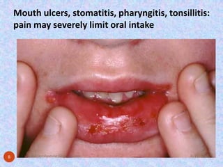 Mouth ulcers, stomatitis, pharyngitis, tonsillitis: pain may severely limit oral intake9/15/2014 
8 
www.drjayeshpatidar.blogspot.com  