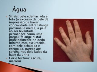    Sinais: pele edemaciada e
    fofa (o excesso de pele dá
    impressão de haver
    concavidade entre falange
    proximal e média, a pele
    ao ser levantada
    permanece como uma
    prega); falange distal
    principalmente do dedo
    mínimo está escurecida,
    com pele achatada e
    enrugada, parece até
    cortina nos dois lados da
    base da unha
   Cor e textura: escura,
    marrom
 
