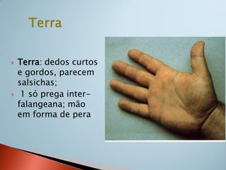    Terra: dedos curtos
    e gordos, parecem
    salsichas;
    1 só prega inter-
    falangeana; mão
    em forma de pera
 
