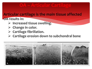 OA – Articular Cartilage
Articular cartilage is the main tissue affected
OA results in:
 Increased tissue swelling.
 Change in color.
 Cartilage fibrillation.
 Cartilage erosion down to subchondral bone
 