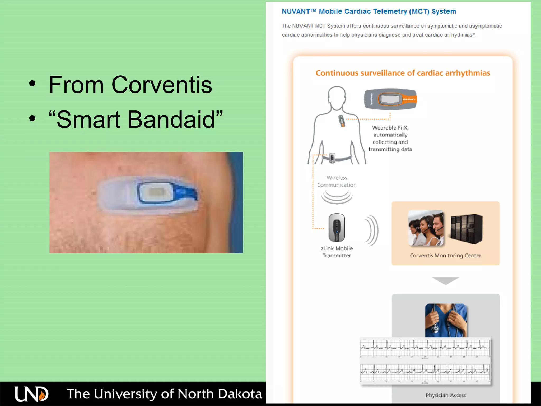 • From Corventis
• “Smart Bandaid”
 
