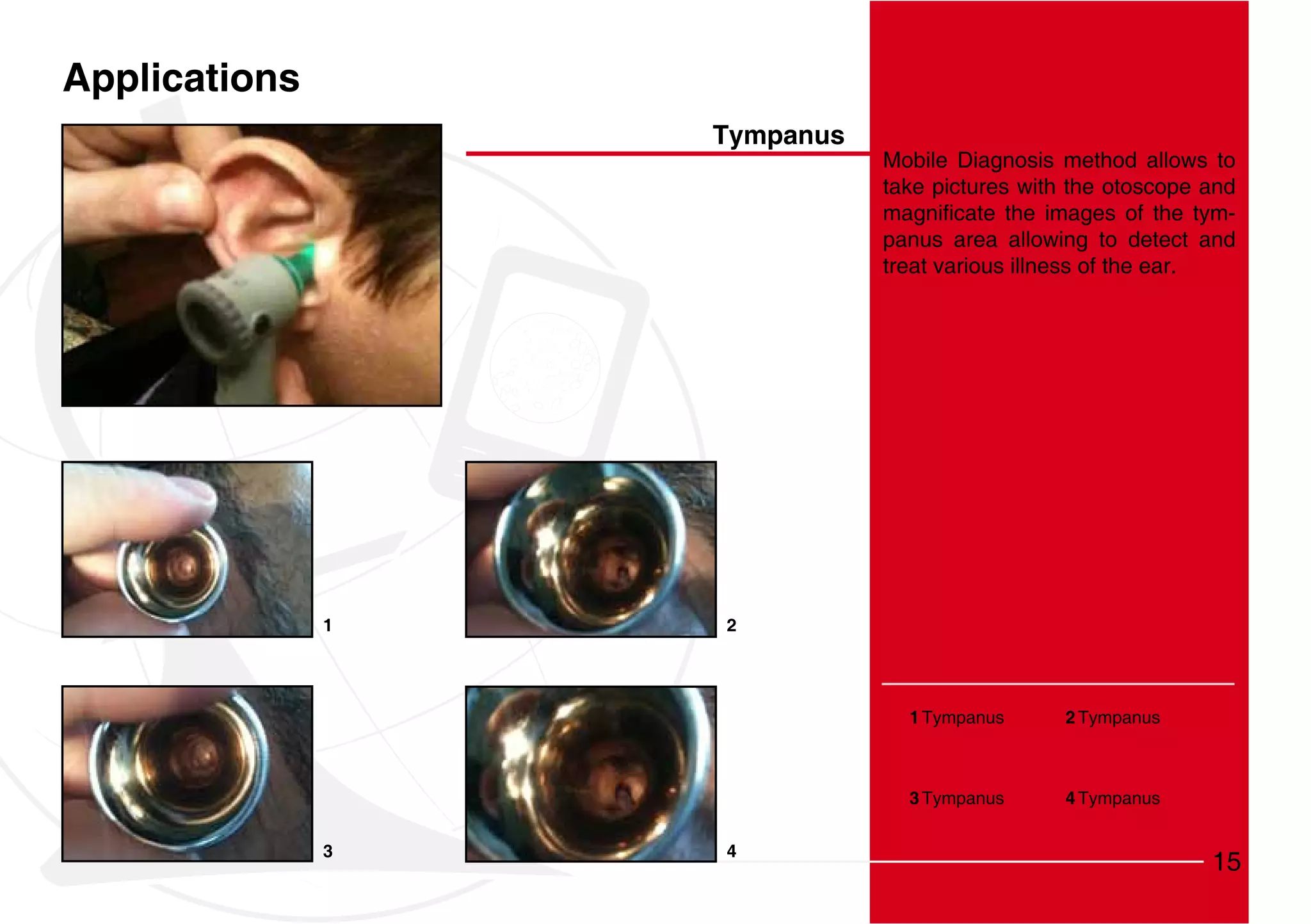 Applications
                   Tympanus
                              Mobile Diagnosis method allows to
                              take pictures with the otoscope and
                                                                -
                              panus area allowing to detect and
                              treat various illness of the ear.




               1   2




                                1 Tympanus      2 Tympanus



                                3 Tympanus      4 Tympanus


               3   4
                                                              15
 