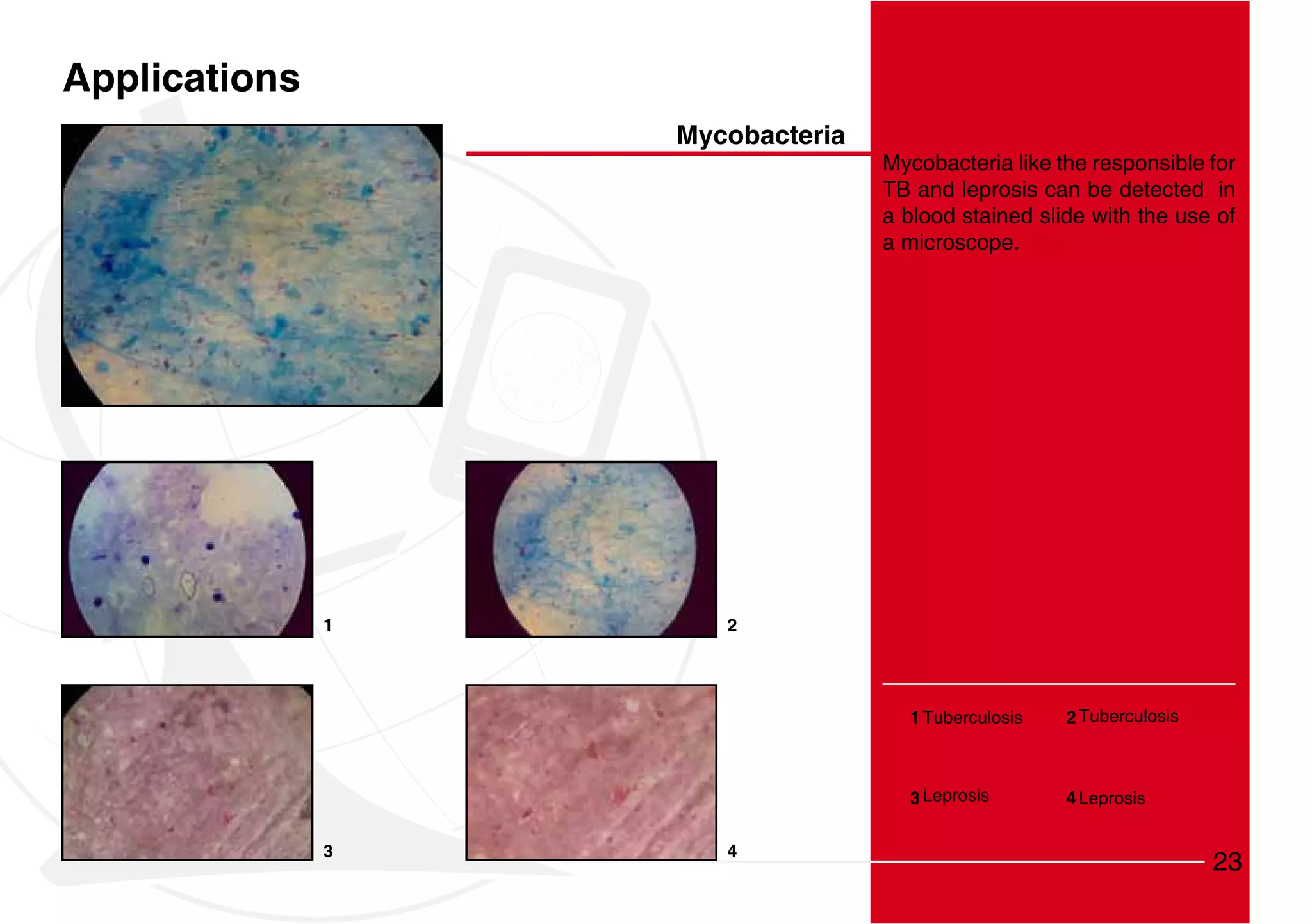 Applications
                   Mycobacteria
                                  Mycobacteria like the responsible for
                                  TB and leprosis can be detected in
                                  a blood stained slide with the use of
                                  a microscope.




               1      2




                                    1 Tuberculosis   2 Tuberculosis



                                    3 Leprosis       4 Leprosis


               3      4
                                                                      23
 