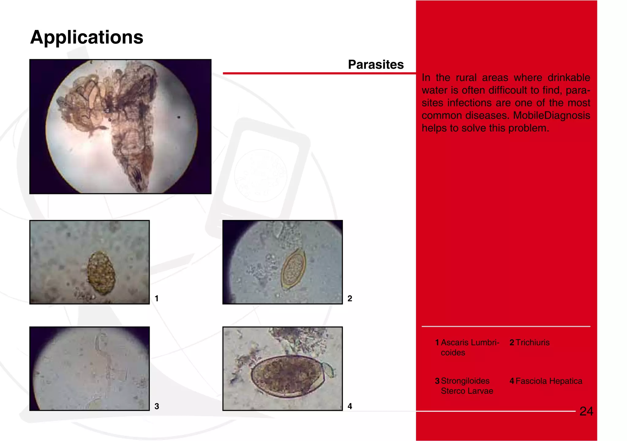Applications
                   Parasites
                               In the rural areas where drinkable
                                                                  -
                               sites infections are one of the most
                               common diseases. MobileDiagnosis
                               helps to solve this problem.




               1   2




                                 1 Ascaris Lumbri-   2 Trichiuris
                                   coides


                                 3 Strongiloides     4 Fasciola Hepatica
                                   Sterco Larvae
               3   4
                                                                       24
 
