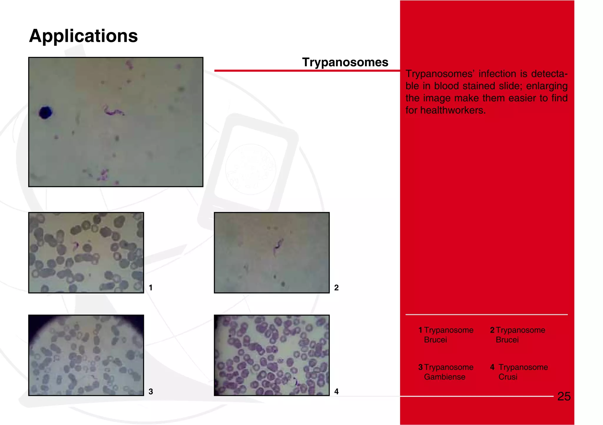 Applications
                   Trypanosomes
                                  Trypanosomes’ infection is detecta-
                                  ble in blood stained slide; enlarging

                                  for healthworkers.




               1       2




                                    1 Trypanosome      2 Trypanosome
                                      Brucei             Brucei


                                    3 Trypanosome      4 Trypanosome
                                      Gambiense          Crusi
               3       4
                                                                       25
 