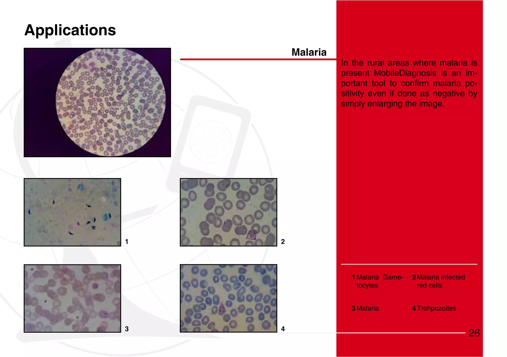 Applications
                       Malaria
                                 In the rural areas where malaria is
                                 present MobileDiagnosis is an im-
                                                                    -
                                 sitivity even if done as negative by
                                 simply enlarging the image.




               1   2




                                   1 Malaria Game-   2 Malaria infected
                                     tocytes           red cells


                                   3 Malaria         4 Trohpozoites


               3   4
                                                                          26
 