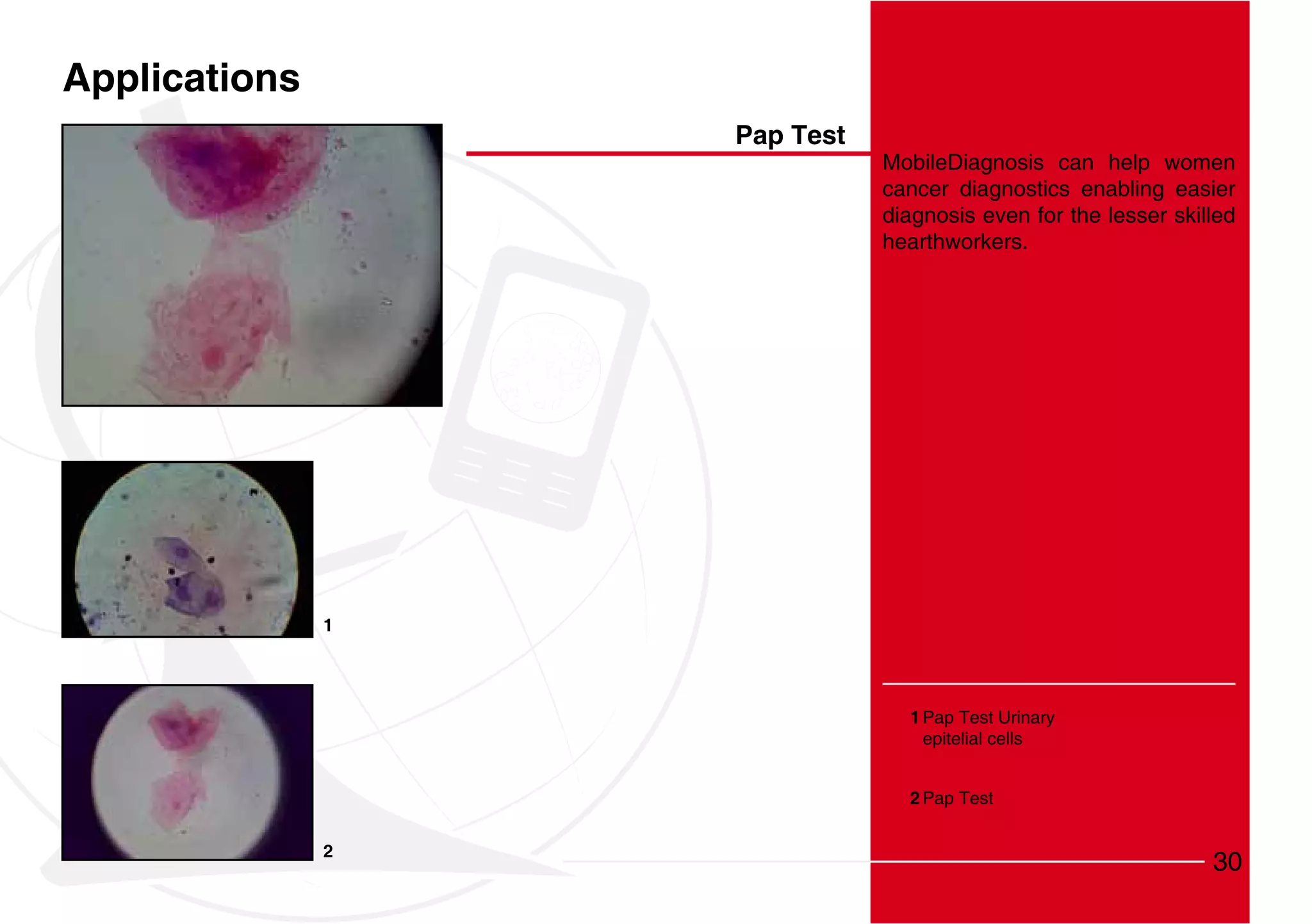 Applications
                   Pap Test
                              MobileDiagnosis can help women
                              cancer diagnostics enabling easier
                              diagnosis even for the lesser skilled
                              hearthworkers.




               1




                                1 Pap Test Urinary
                                  epitelial cells


                                2 Pap Test


               2
                                                                30
 