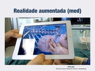 Realidade aumentada (med)
MITK pille
German Cancer Research Center in Heidelberg.
 