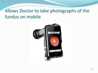 Allows Doctor to take photographs of the
fundus on mobile
49
 