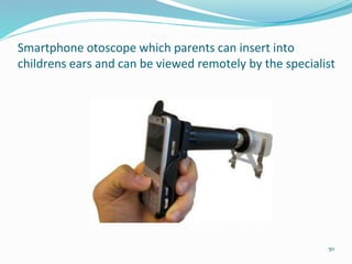 Smartphone otoscope which parents can insert into
childrens ears and can be viewed remotely by the specialist
50
 