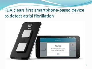 FDA clears first smartphone-based device
to detect atrial fibrillation
51
 