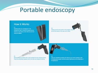Portable endoscopy
54
 