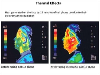 Thermal Effects  Heat generated on the face by 15 minutes of cell phone use due to their electromagnetic radiation 