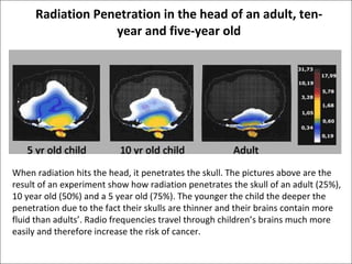 Radiation Penetration in the head of an adult, ten-year and five-year old When radiation hits the head, it penetrates the skull. The pictures above are the result of an experiment show how radiation penetrates the skull of an adult (25%), 10 year old (50%) and a 5 year old (75%). The younger the child the deeper the penetration due to the fact their skulls are thinner and their brains contain more fluid than adults’. Radio frequencies travel through children’s brains much more easily and therefore increase the risk of cancer. 
