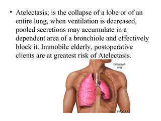 • Atelectasis; is the collapse of a lobe or of an
  entire lung, when ventilation is decreased,
  pooled secretions may accumulate in a
  dependent area of a bronchiole and effectively
  block it. Immobile elderly, postoperative
  clients are at greatest risk of Atelectasis.
 