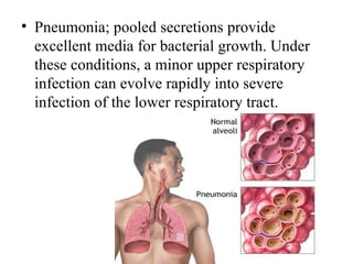 • Pneumonia; pooled secretions provide
  excellent media for bacterial growth. Under
  these conditions, a minor upper respiratory
  infection can evolve rapidly into severe
  infection of the lower respiratory tract.
 