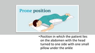 • Position in which the patient lies
on the abdomen with the head
turned to one side with one small
pillow under the ankle
 