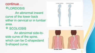 MOBILITY AND IMMOBILITY and about the .pptx