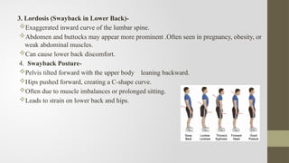 Mobility and Immobility in Nursing...... | PPTX