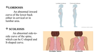 mobility and immobility.pptx Paediatric speciality | PPTX