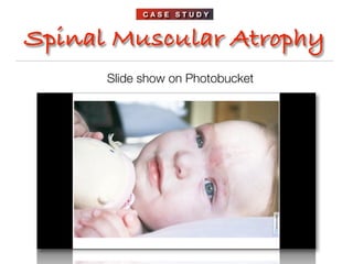 CASE STUDY



Spinal Muscular Atrophy
      Slide show on Photobucket
 