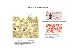 Observação ao microscópio óptico de um
esfregaço de sangue humano com a
ampliação de 800x
CÉLULAS DE SANGUE HUMANO
Observação ao microscópio óptico de leucócitos
Observação ao microscópio
óptico de plaquetas sanguíneas
(entre hemácias).
 