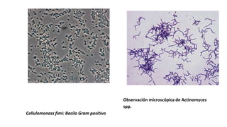 Observación microscópica de Actinomyces
spp.
Cellulomonass fimi: Bacilo Gram positivo
 