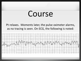 Course
Pt relaxes. Moments later, the pulse oximeter alarms,
as no tracing is seen. On ECG, the following is noted:
 
