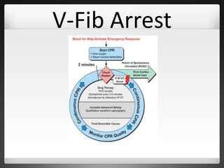 V-Fib Arrest
 