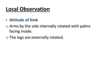 Local Observation
• Attitude of limb
o Arms by the side internally rotated with palms
facing inside.
o The legs are externally rotated.
 