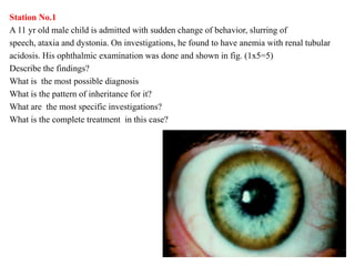 Station No.1
A 11 yr old male child is admitted with sudden change of behavior, slurring of
speech, ataxia and dystonia. O...