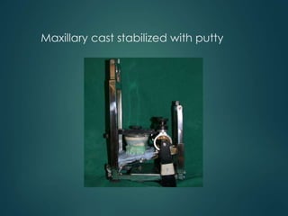 Mock surgery,softwares & advances orthognathic | PPTX