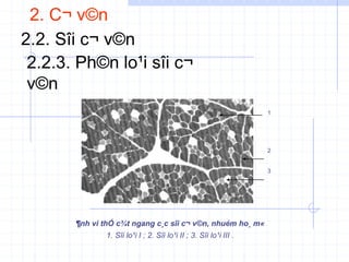 2. C¬ v©n
2.2. Sîi c¬ v©n
2.2.3. Ph©n lo¹i sîi c¬
v©n
1
2
3
¶nh vi thÓ c¾t ngang c¸c sîi c¬ v©n, nhuém ho¸ m«
1. Sîi lo¹i I ; 2. Sîi lo¹i II ; 3. Sîi lo¹i III .
 