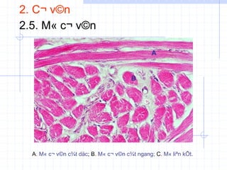 2. C¬ v©n
2.5. M« c¬ v©n
A. M« c¬ v©n c¾t däc; B. M« c¬ v©n c¾t ngang; C. M« liªn kÕt.
C
 