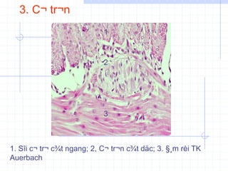 3. C¬ tr¬n
1
3
2
1. Sîi c¬ tr¬ c¾t ngang; 2, C¬ tr¬n c¾t däc; 3. §¸m rèi TK
Auerbach
 
