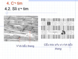 4. C¬ tim
4.2. Sîi c¬ tim
V¹ch bËc thang CÊu tróc siªu vi v¹ch bËc
thang
 