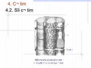 4. C¬ tim
4.2. Sîi c¬ tim
1
vi qu¶n T
2
1
CÊu t¹o siªu vi cña sîi c¬ tim
1. Vi qu¶n T; 2. Líi néi bµo; * Diat
 