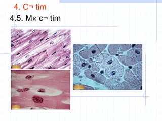 4. C¬ tim
4.5. M« c¬ tim
 