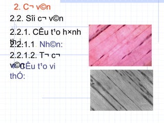 2. C¬ v©n
2.2. Sîi c¬ v©n
2.2.1. CÊu t¹o h×nh
th¸i.
2.2.1.1. Nh©n:
2.2.1.2. T¬ c¬
v©n
 CÊu t¹o vi
thÓ:
 