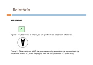 Relatório

RESULTADOS



           A

Figura 1 – Observação a olho nú, de um quadrado de papel com a letra “A”.




Figura 2- Observação ao MOC, de uma preparação temporária de um quadrado de
papel com a letra “A”, numa ampliação total de 50x (objectiva 5x; ocular 10x).
 