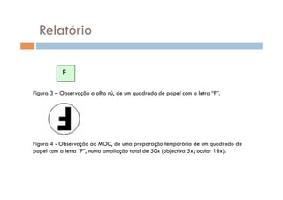 Relatório

           F

Figura 3 – Observação a olho nú, de um quadrado de papel com a letra “F”.




Figura 4 - Observação ao MOC, de uma preparação temporária de um quadrado de
papel com a letra “F”, numa ampliação total de 50x (objectiva 5x; ocular 10x).
 