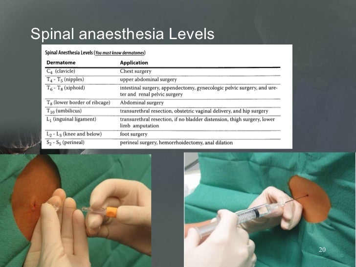 regional anesthesia and beir block