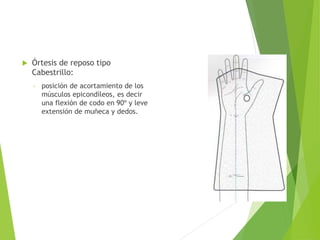 Confección de Órtesis
 Órtesis de reposo tipo
Cabestrillo:
◦ posición de acortamiento de los
músculos epicondíleos, es decir
una flexión de codo en 90º y leve
extensión de muñeca y dedos.
 