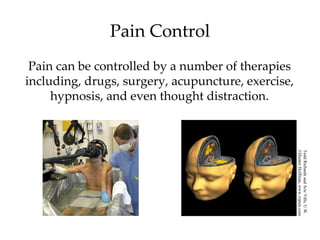 Pain Control
 Pain can be controlled by a number of therapies
including, drugs, surgery, acupuncture, exercise,
     hypnosis, and even thought distraction.




                                                    ©Hunter Hoffman, www.vrpain.com
                                                    Todd Richards and Aric Vills, U.W.
 