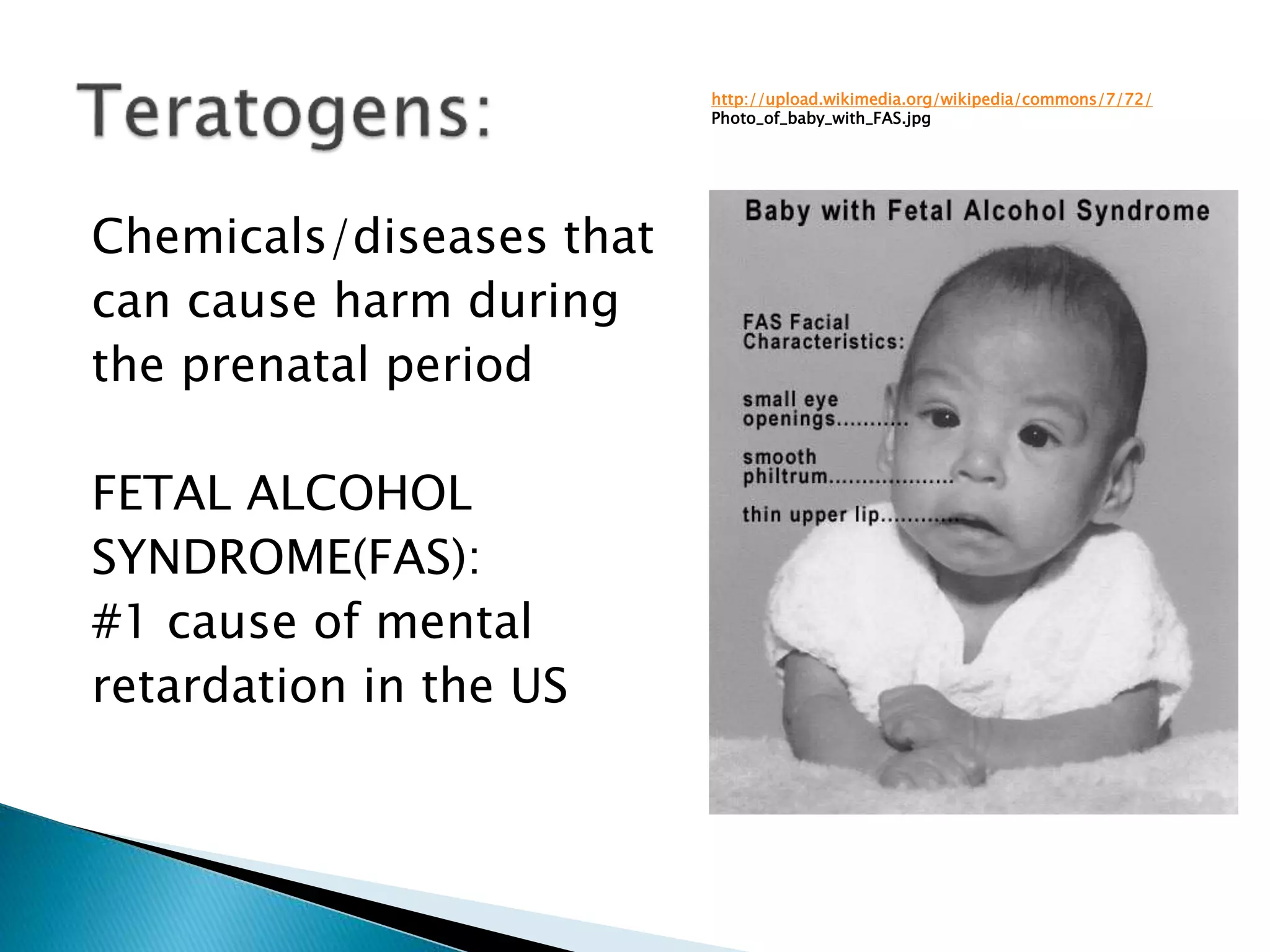 http://upload.wikimedia.org/wikipedia/commons/7/72/
Photo_of_baby_with_FAS.jpg
Chemicals/diseases that
can cause harm during
the prenatal period
FETAL ALCOHOL
SYNDROME(FAS):
#1 cause of mental
retardation in the US
 