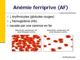 Anémie ferriprive (AF)
↓ érythrocytes (globules rouges)
↓ hémoglobine (Hb)
causée par une carence en fer
 